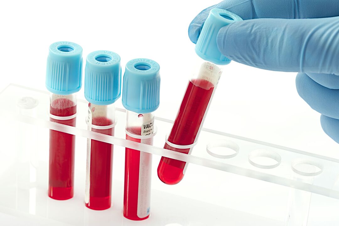 tests sanguins pour diagnostiquer le papillomavirus humain